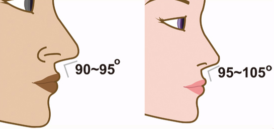 隆鼻-立體結構式隆鼻-卡麥拉隆鼻-縮鼻翼-大韓隆鼻-結構式隆鼻-彤顏診所-整形外科-蒜頭鼻-劉宏貞醫師-隆鼻價格-隆鼻費用